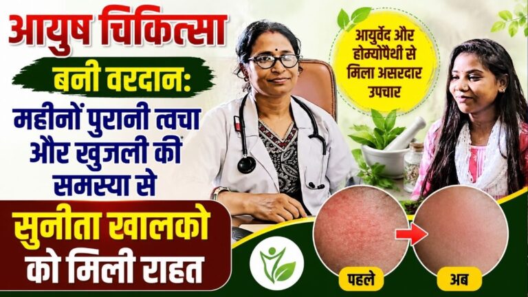 Ayush चिकित्सा बनी वरदान महीनों पुरानी त्वचा और खुजली की समस्या से सुनीता खालको को मिली राहत