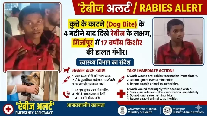 कुत्ते के काटने (Dog Bite) के 4 महीने बाद दिखे रेबीज के लक्षण, मिर्जापुर में 17 वर्षीय किशोर की हालत गंभीर 4 THE NEWS FRAME